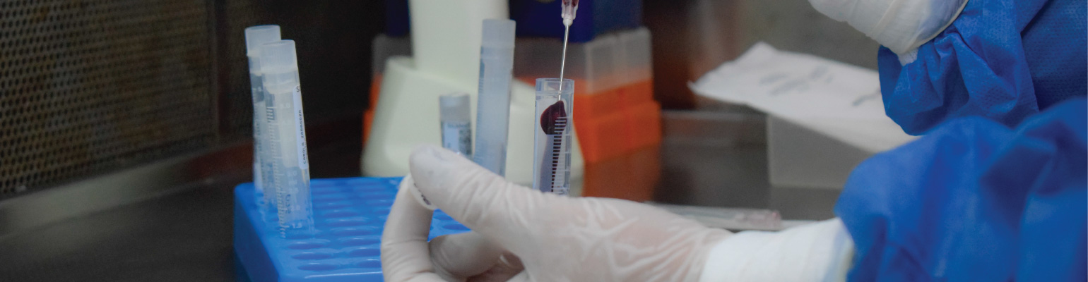 Lee más sobre el artículo Primera mujer curada de VIH por un trasplante de células madre